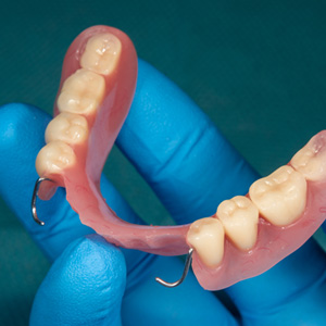 Dentist holding partial dentures