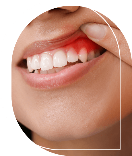 Person pointing to red spot in their gums before gum disease treatment in Wallingford